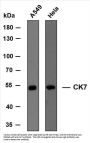 Cytokeratin 7 (ABT-CK7) Antibody