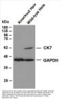Cytokeratin 7 (ABT-CK7) Antibody