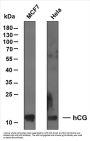 hCG α (ABT-HCG) Antibody