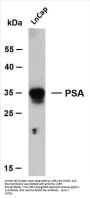 PSA (ABT-PSA) Antibody