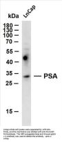PSA (ABT-PSA) Antibody