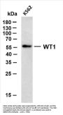 Wilms' Tumor 1(WT1) (ABT-WT1) Antibody
