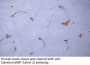 Calretinin (ABT-Calret 1) Antibody