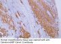 Calretinin (ABT-Calret 1) Antibody