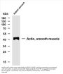 Actin, smooth muscle (SMA) (ABT-SMA) Antibody
