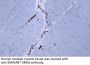 Actin, smooth muscle (SMA) (ABT-SMA) Antibody
