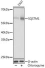 SQSTM1/p62 Rabbit Polyclonal Antibody