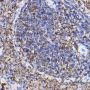 TGF beta Receptor II (TGFBR2) Antibody
