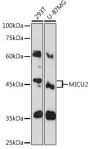 MICU2 Rabbit Polyclonal Antibody