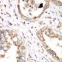 HADHA Rabbit Polyclonal Antibody