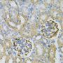AK1 Antibody