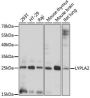 LYPLA2 Rabbit Polyclonal Antibody