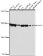 SMC3 Rabbit Monoclonal Antibody