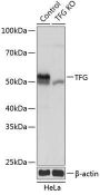 [KO Validated] TRK fused gene (TFG) Rabbit Polyclonal Antibody