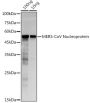MERS-CoV Nucleoprotein Antibody