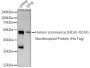 HCoV-OC43 Nucleoprotein Antibody