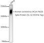 HCoV-NL63 Spike S2 Antibody