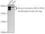 HCoV-HKU1 Nucleoprotein Antibody