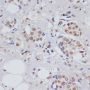 SKIV2L2 Rabbit Polyclonal Antibody