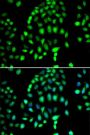 PARP3 Antibody