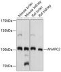 ANAPC2 Rabbit Polyclonal Antibody