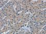 RGS11 Antibody