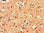 ATXN1L Antibody