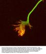 Anti-Amyloid Precursor Protein (APP), Peptide #5 Antibody