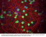 Anti-Coronin 1A Antibody