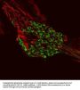 Anti-Metabotropic Glutamate Receptor Type 1 (mGluR1) Antibody