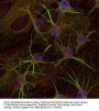 Anti-Glutamic Acid Decarboxylase-67 (GAD 67) Antibody