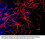 Anti-Glial Fibrillary Acidic Protein (GFAP) Antibody