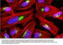 Anti-GOLGA2 (GM130) Antibody