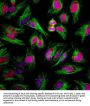 Anti-Ki-67 Antibody