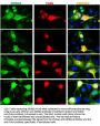 Anti-NDRG2 Antibody