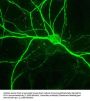 Anti-NFH (Neurofilament Heavy Chain) Antibody