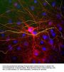 Anti-NFL (Neurofilament Light Chain) Antibody
