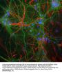 Anti-NFM (Neurofilament Medium Chain) Antibody