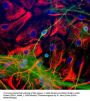 Anti-Neuron-Specific Enolase (NSE) Type 2 Antibody