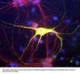 Anti-Peripherin Antibody