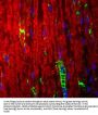 Anti-P-Zero Myelin Protein (PZO) Antibody