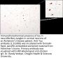 Anti-Tau Antibody