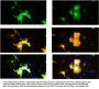 Anti-TPH2 Antibody