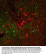 Anti-Tyrosine Hydroxylase (TYH) Antibody