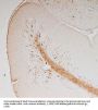 Anti-Vimentin Protein Antibody