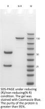V6 Anti-Human PSMA (Rosopatamab)