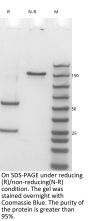 Anti-Human SOST(Blosozumab)
