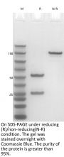 V6 Anti-Human ANGPTL3 (Evinacumab)