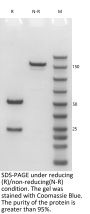 Anti-Human PD-1(Cemiplimab)