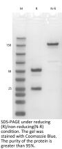 Anti-Human CD254(Denosumab)